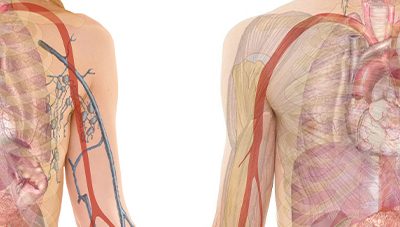 Locating the Cause of Poor Breathing: Frozen Diaphragm Syndrome